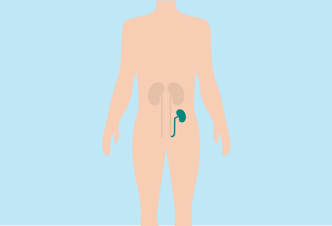 7. BAXTER_DTP_ContentPage_HD_in_What is a kidney transplant.png